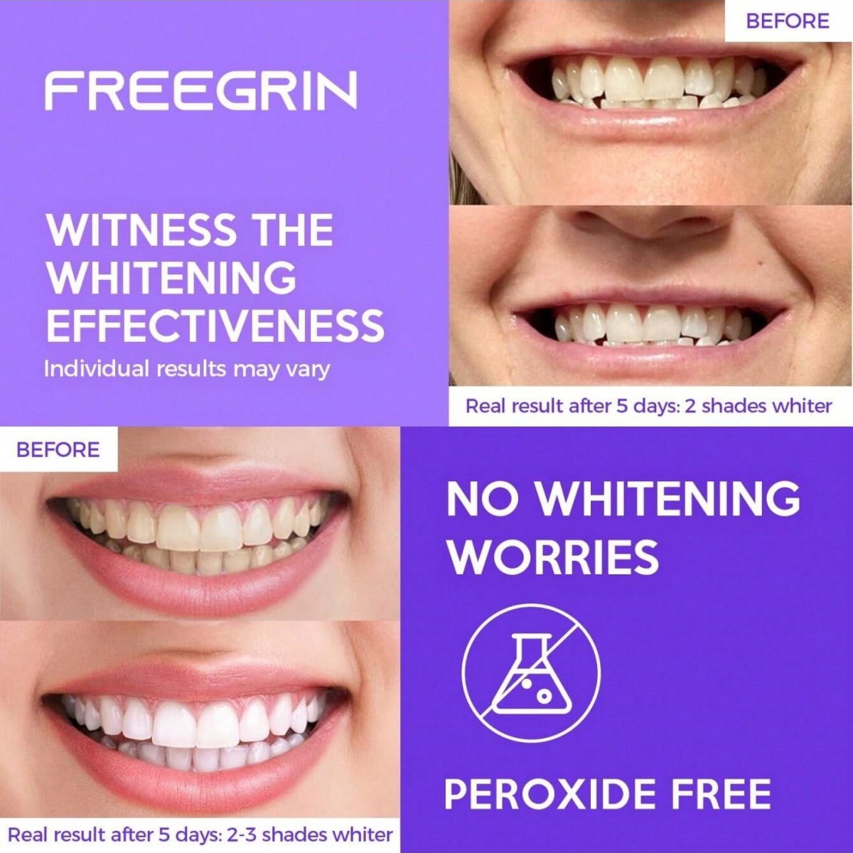Deluxe Whitening Teeth Sticker - đánh giá và giá Home Fragrance Gel
